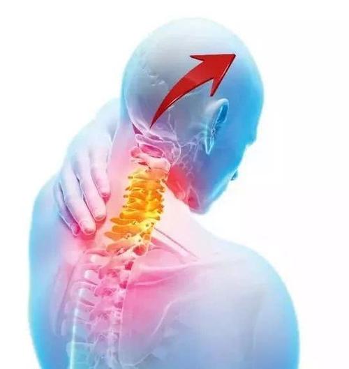 颈源性头痛——头痛为什么与颈部有关？